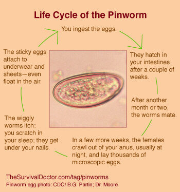 How do you get rid of pinworms without medication?